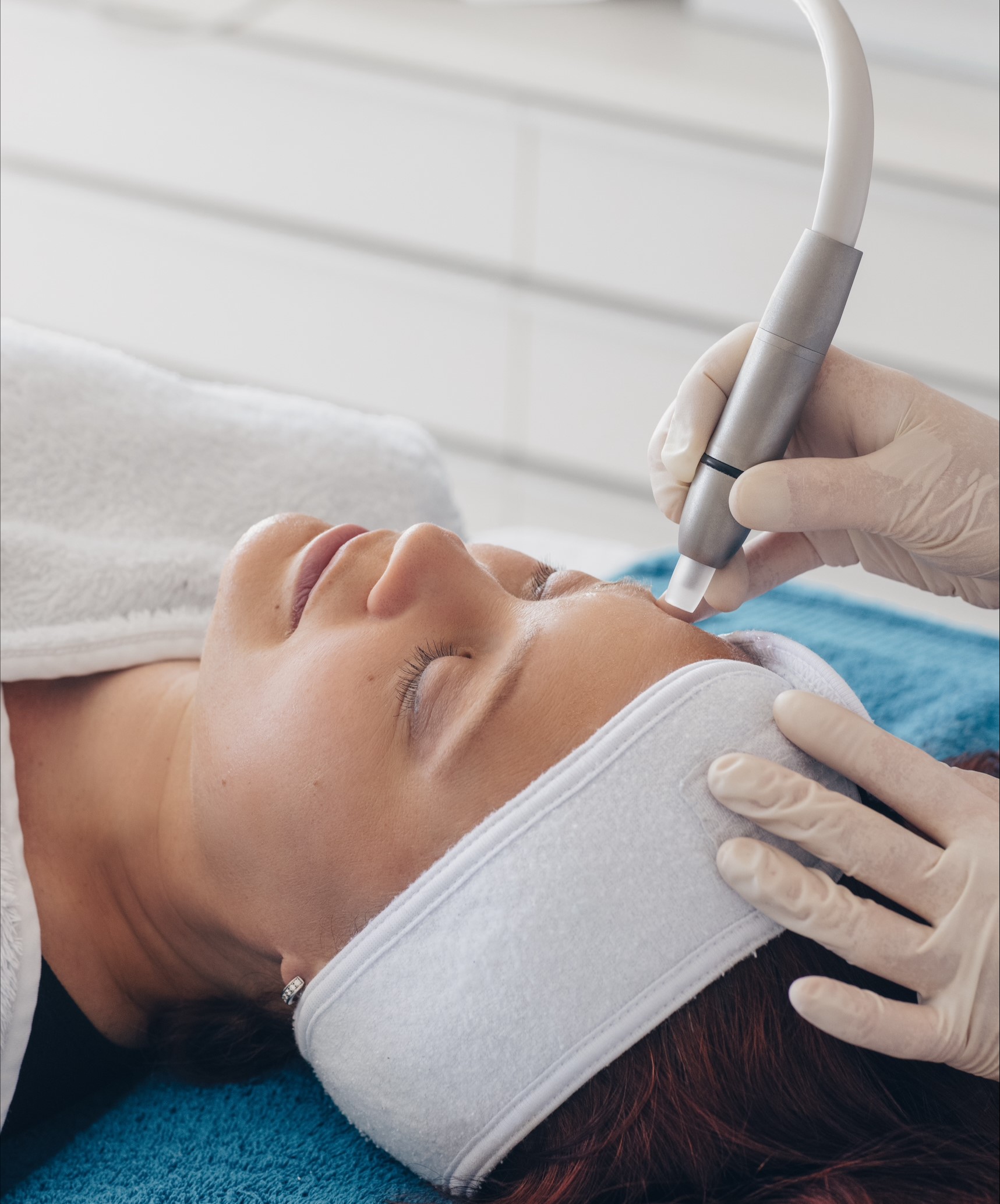 Clean Medical Cosmetic Microdermabrasion Dermatude Olten und Aarau